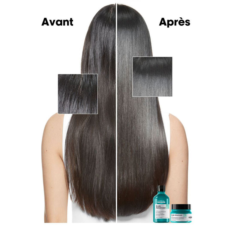 Avant/apr&egrave;s utilisation de la gamme Scalp Advanced